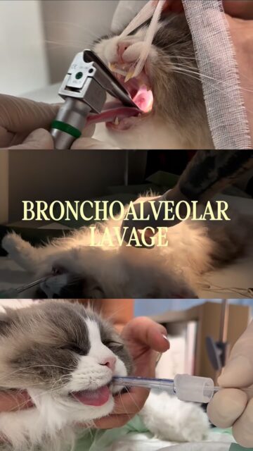 🐱Chronic Cough…
This Ragdoll had been experiencing a chronic cough for around a year. Steroids had previously improved the symptoms, but the cough returned once treatment was stopped.
To investigate the underlying cause, we performed a bronchoalveolar lavage (BAL)🫁
During a BAL, sterile fluid is introduced into the lower airways and then gently collected back. The sample can then be examined and sent for further testing to look for inflammation, infection or other changes within the lungs.
BAL can be a valuable diagnostic tool when investigating chronic respiratory signs such as coughing, helping us understand what is happening within the lungs and choose the most appropriate treatment for each patient. 🩺🩵
#veterinarymedicin #felinemedicine #bronchoalveolarlavage #cathealth #ragdoll